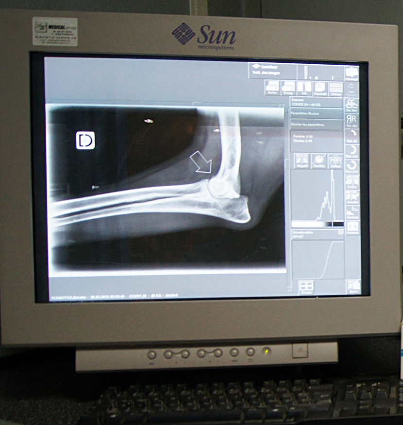 Vue radiographie numérique coude chien