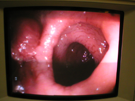Image d'Endoscopie Digestive